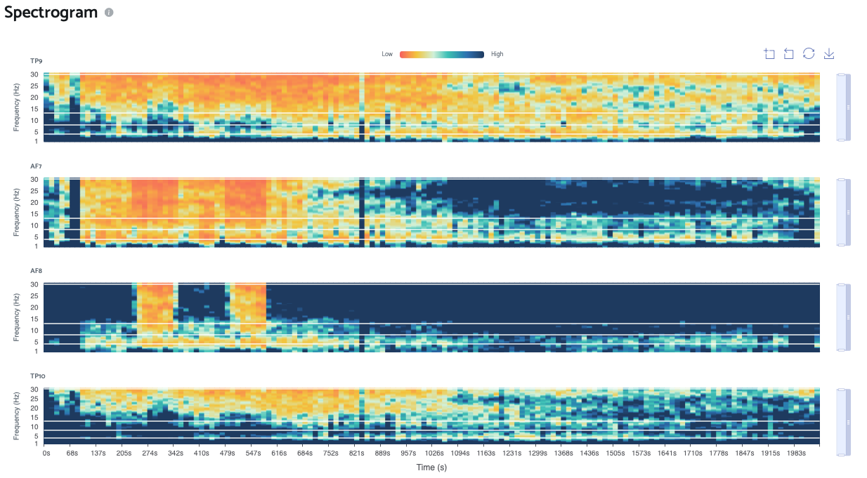 Spectrogram view showing frequency power over time per channel